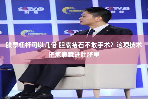 股票杠杆可以几倍 胆囊结石不敢手术？这项技术把疤痕藏进肚脐里
